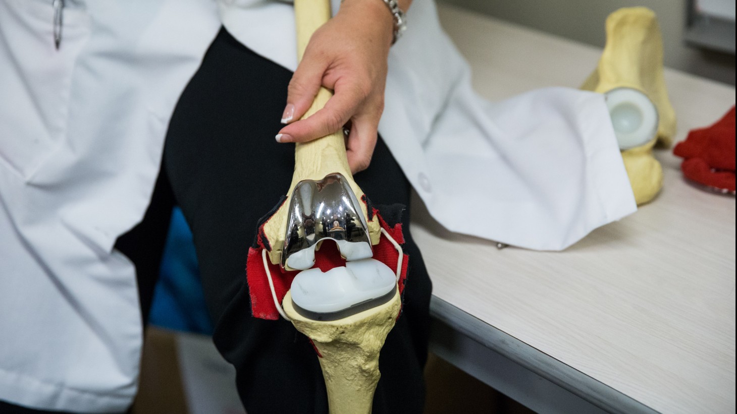 model of a knee replacement 
