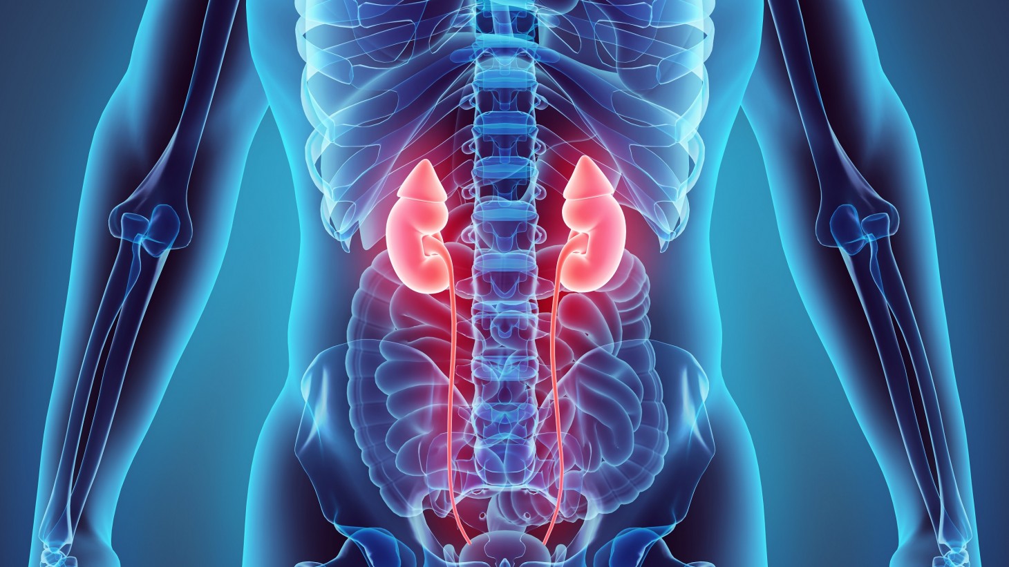 xray image of internal organs, including kidneys